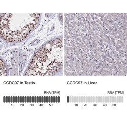 CCDC97 Antibody, Novus Biologicals:Antibodies:Primary Antibodies